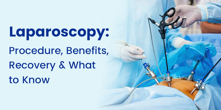 Laparoscopy: Procedure, Benefits, Recovery & What to Know