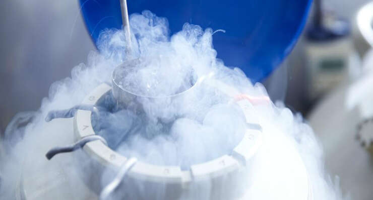 Egg Freezing