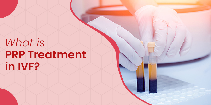 PRP Treatment