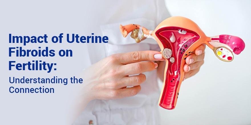 Uterine Fibroids