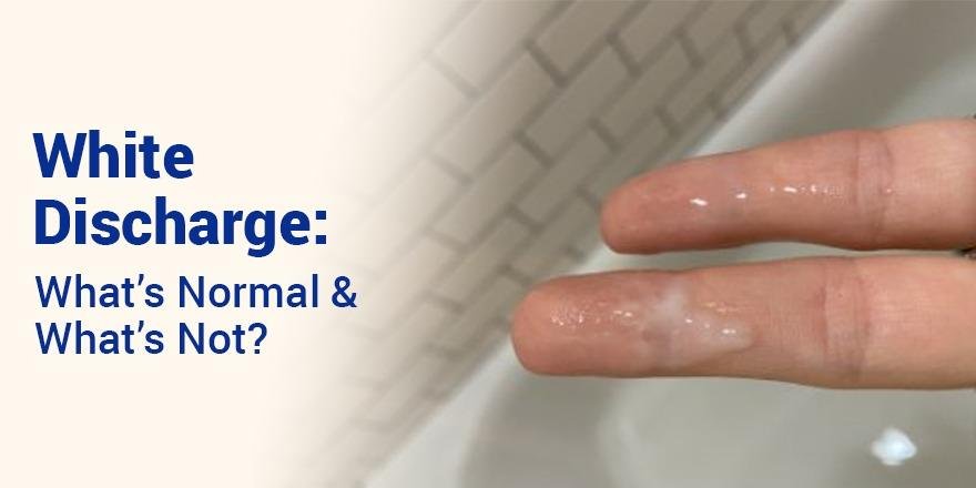 White Discharge